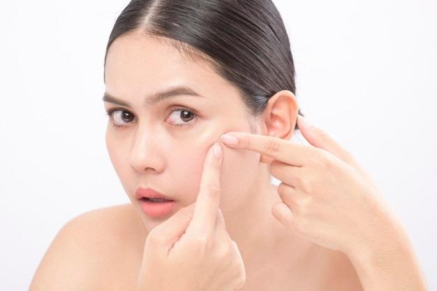 Acne Scar Treatment in Jabalpur