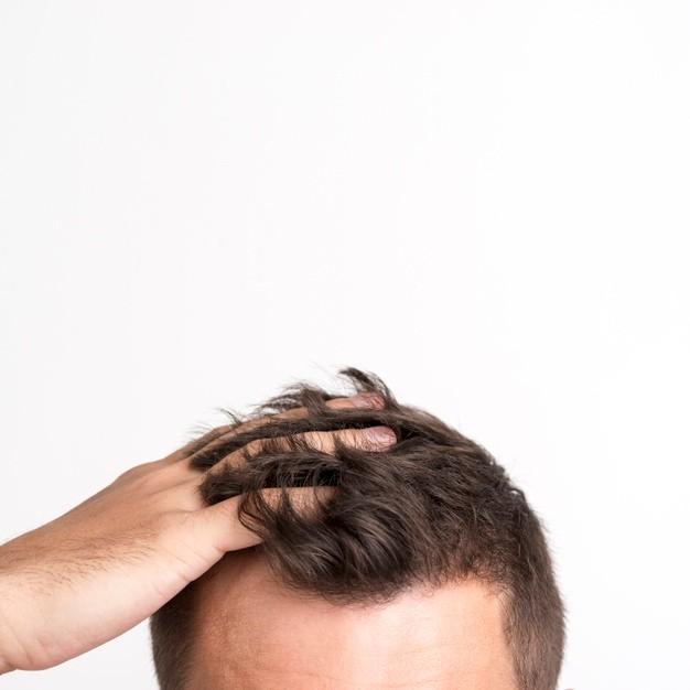 Hair Loss and Hair Fall