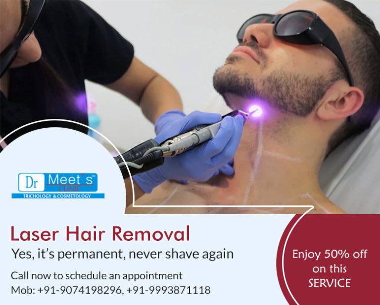 Laser Hair Removal