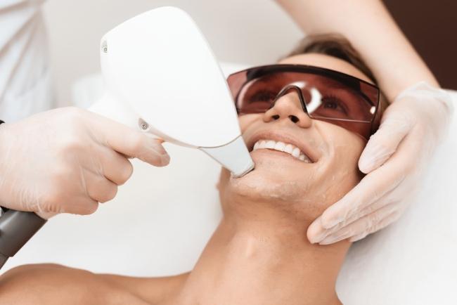 Laser hair removal for men