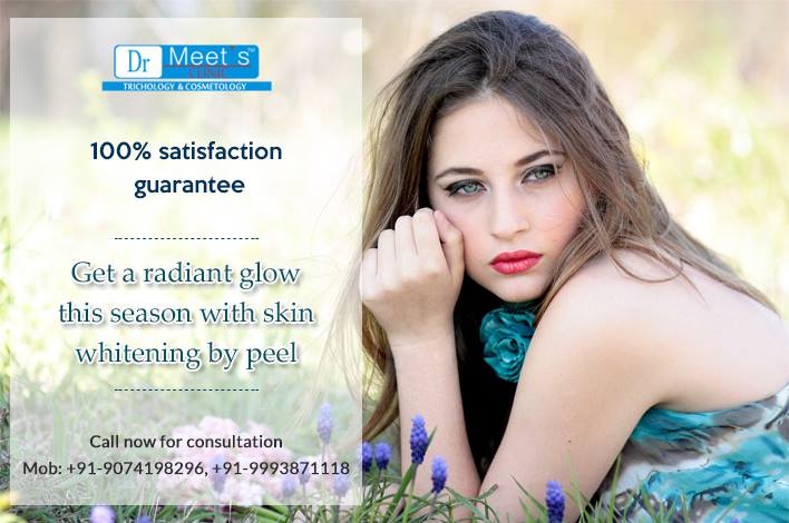 Skin Whitening Treatment