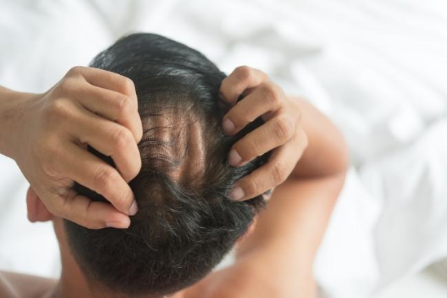 hair loss treatment