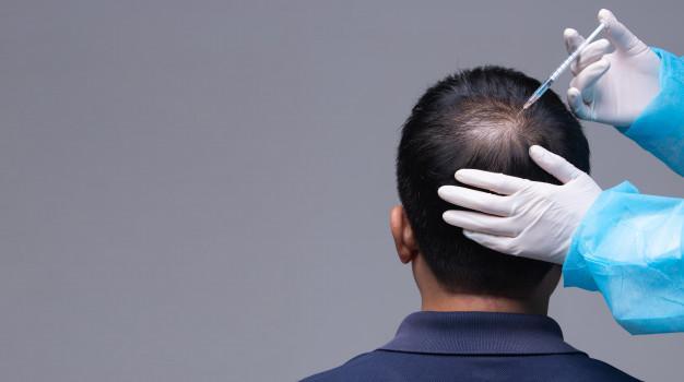 hair transplantation