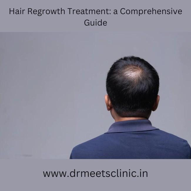 Hair Regrowth Treatment