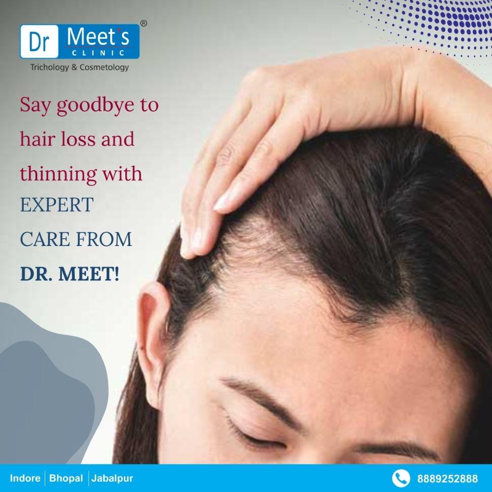 Hair Fall Treatment in Bhicholi Hapsi, Indore