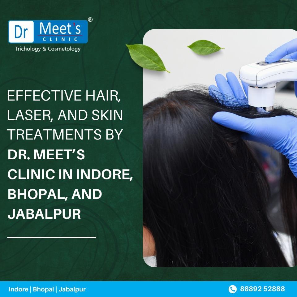 Hair Fall Treatment in Annapurna Road Indore