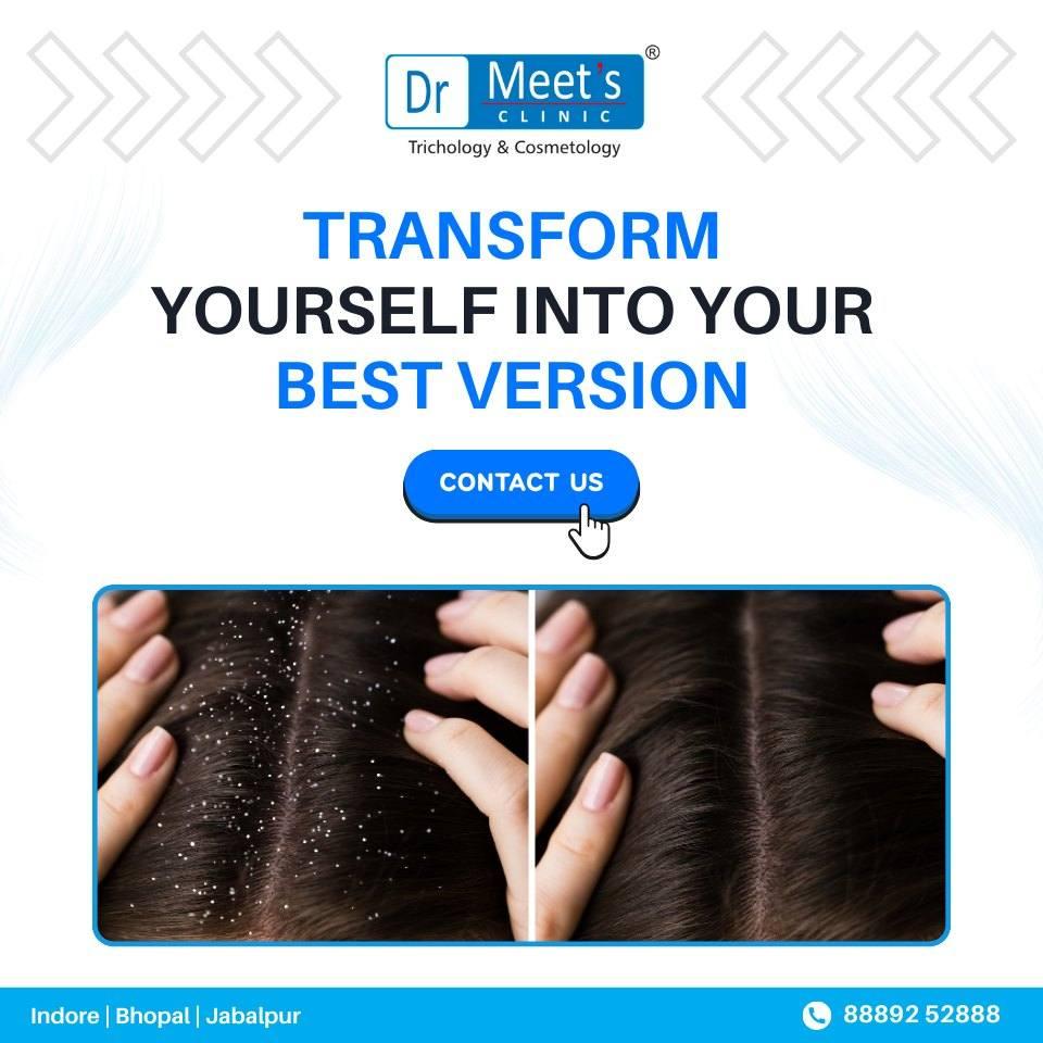 Dhar Road hair care clinic for hair fall