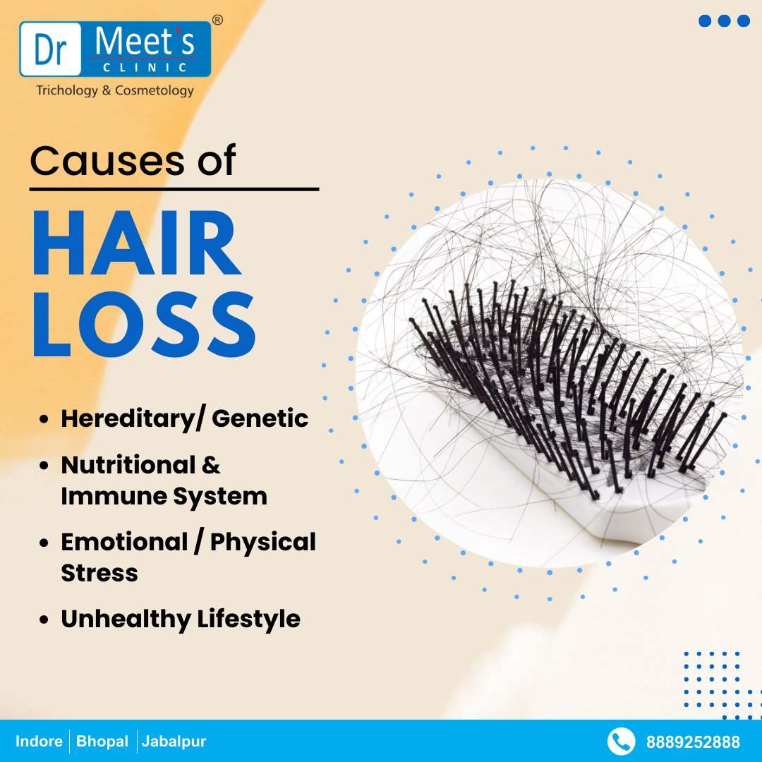 Hair loss treatment Dhar Road Indore