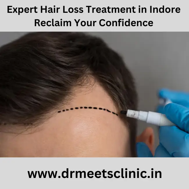 hair loss treatment in Indore