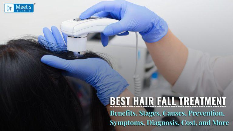 Best Hair Fall Treatment in Indore: Benefits, Stages, Causes, Prevention & Cost