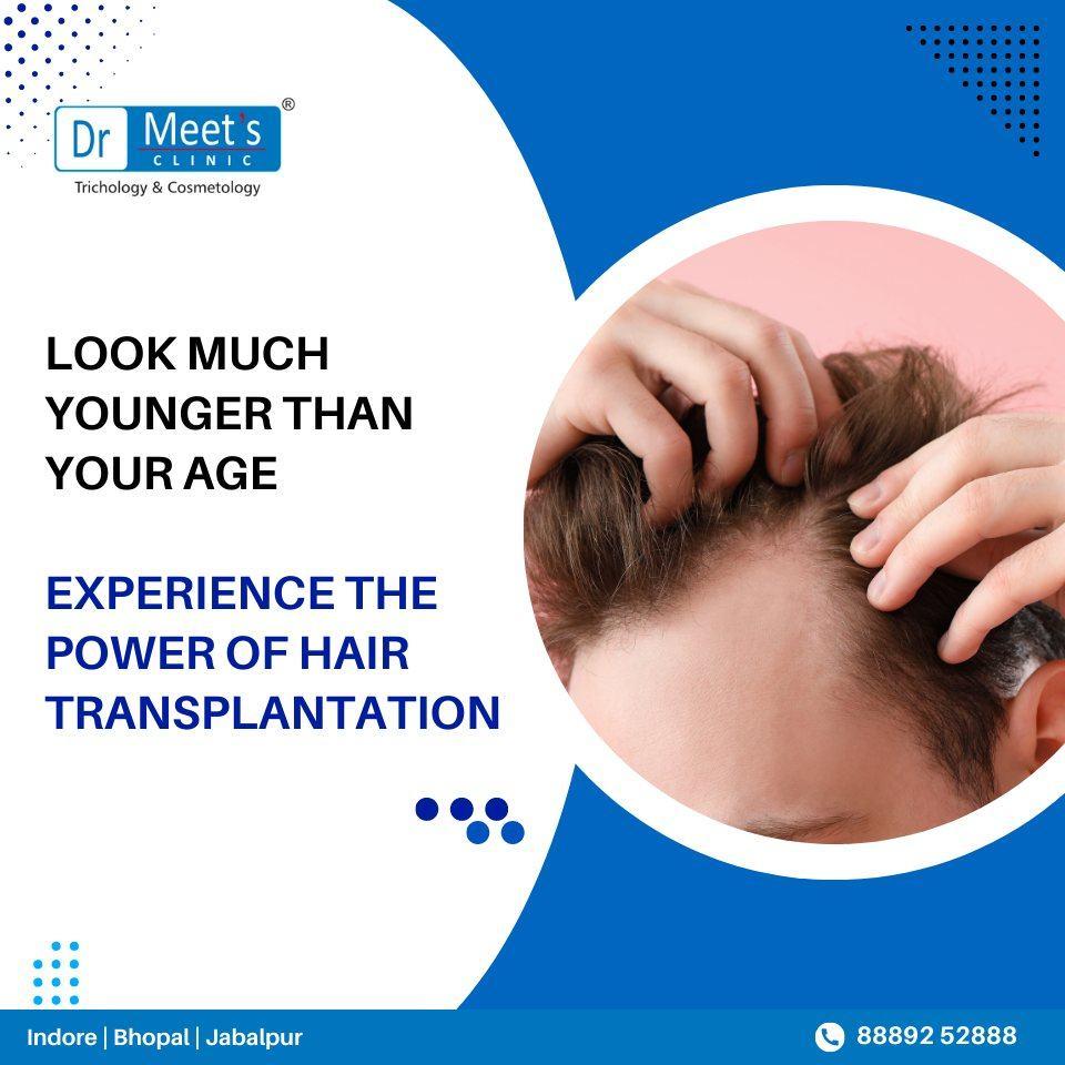 Effective Hair Loss Treatment in Pipliyahana Square Indore