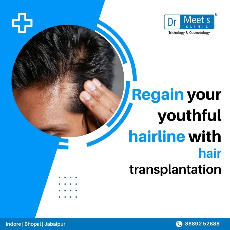 Hair fall Treatment in Bicholi Mardana Road, Indore