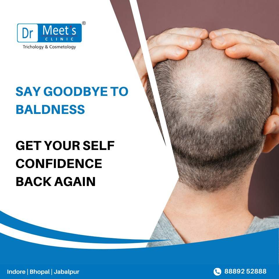 Hair Loss Clinics near Pipliyahana Square Indore