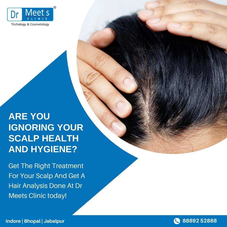 Hair Loss Treatment in Arera Colony Bhopal