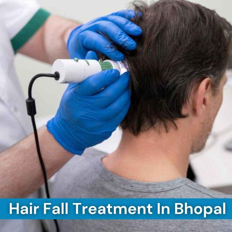 Hair Fall Treatment in Berasia Road, Bhopal
