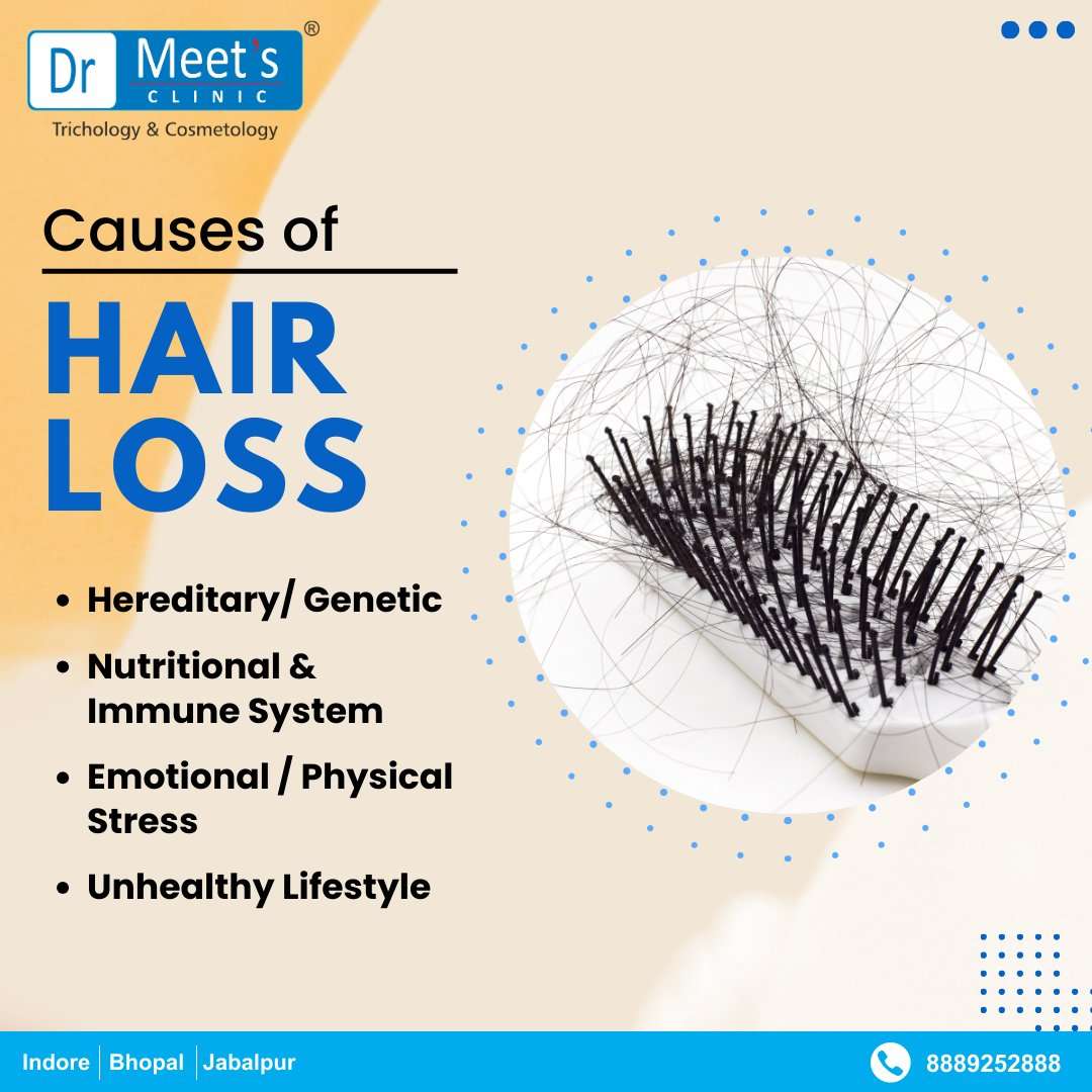 Hair Loss Treatment Jail Road Indore