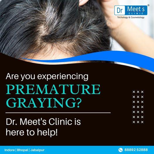 Hair fall specialists MG Road Indore