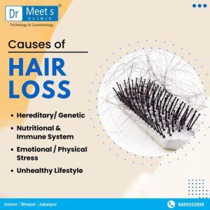 Hair fall specialists Kanadia Road Indore