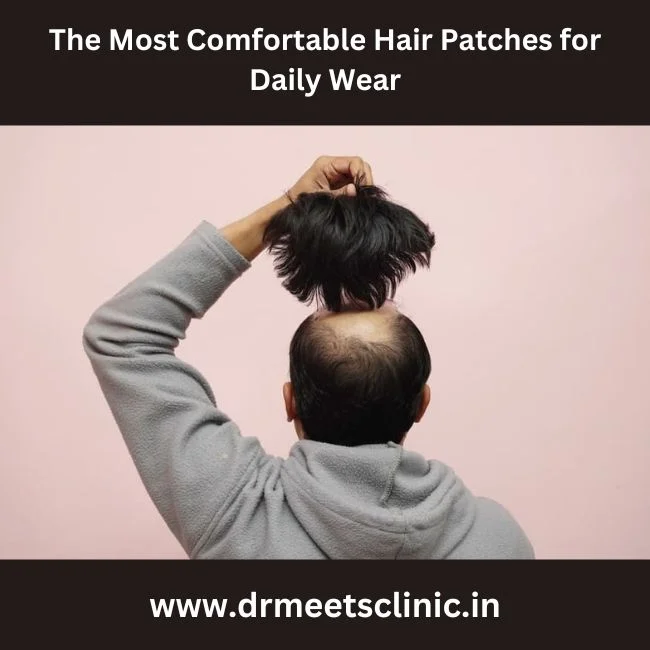 Hair patch in Indore