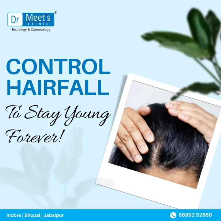 Hair Fall Treatment in Manik Bagh Road Indore