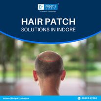 Best Hair Loss Treatment Manik Bagh Road Indore