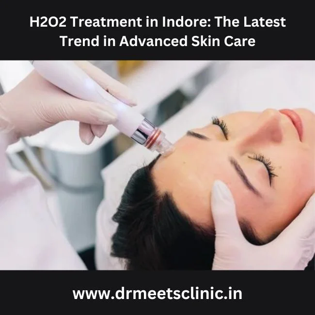 H2O2 Treatment in Indore