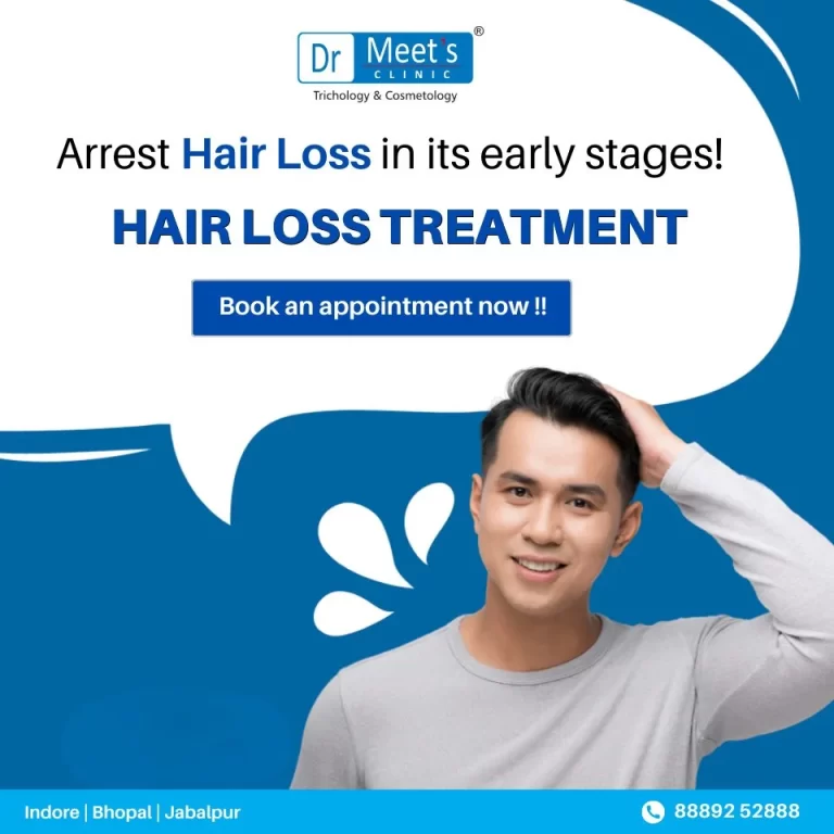 Hair Fall Treatment in Vijay Nagar Indore