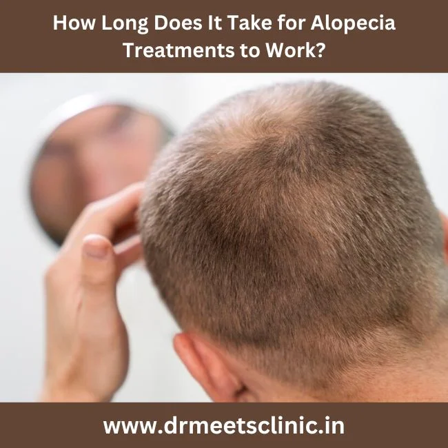 Best Alopecia Treatment in Indore