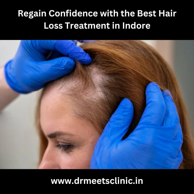 Best Hair Loss Treatment in Indore