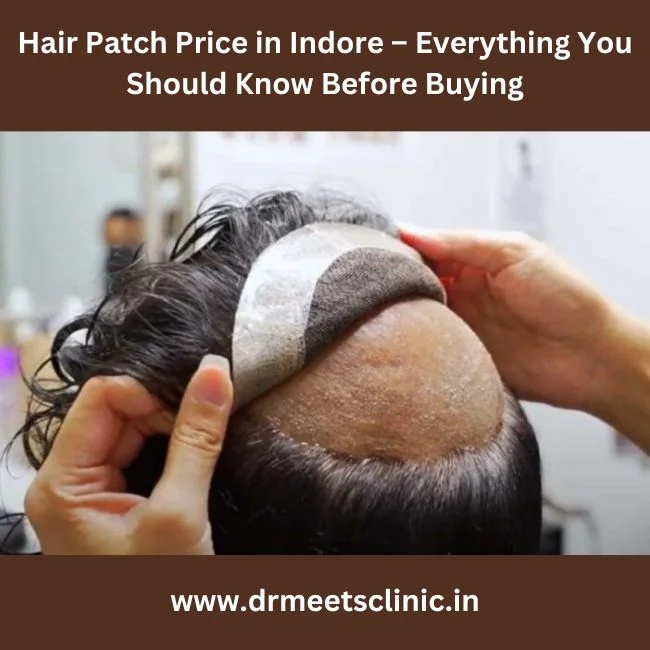 Hair Patch Price in Indore