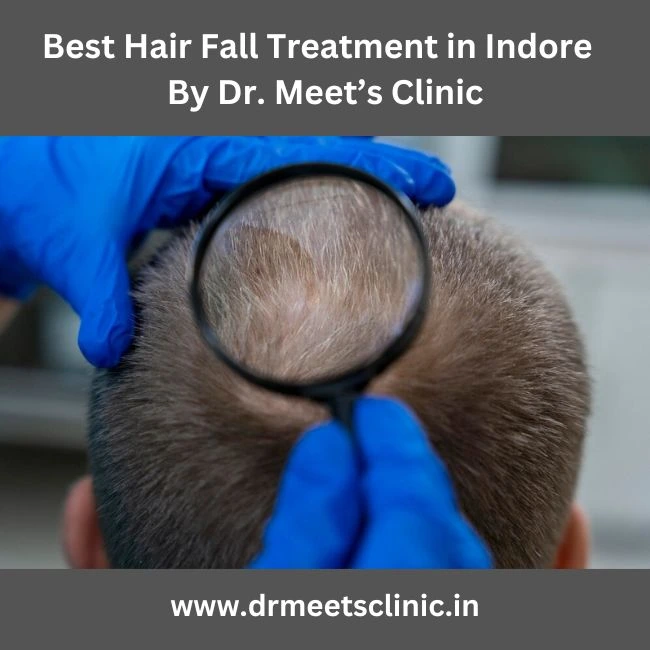 Best Hair Fall Treatment in Indore