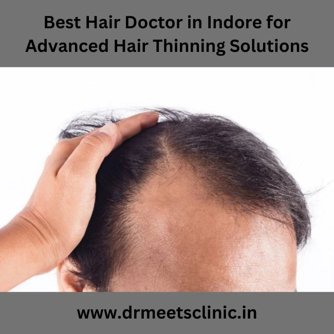 Best Hair Doctor in Indore