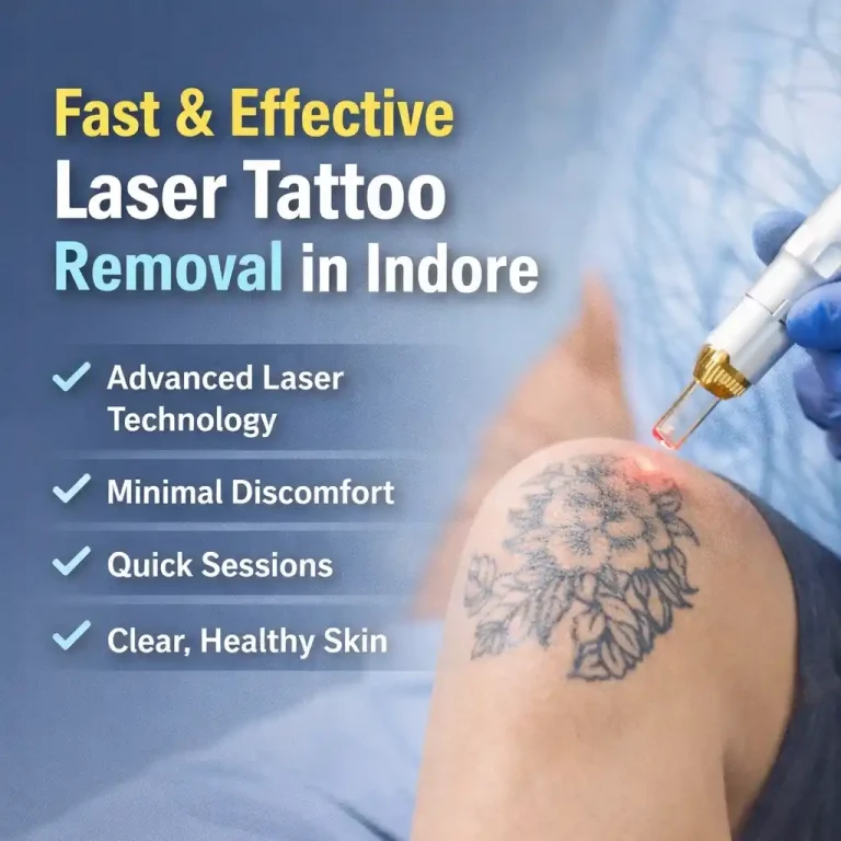 Laser Tattoo Removal in Indore