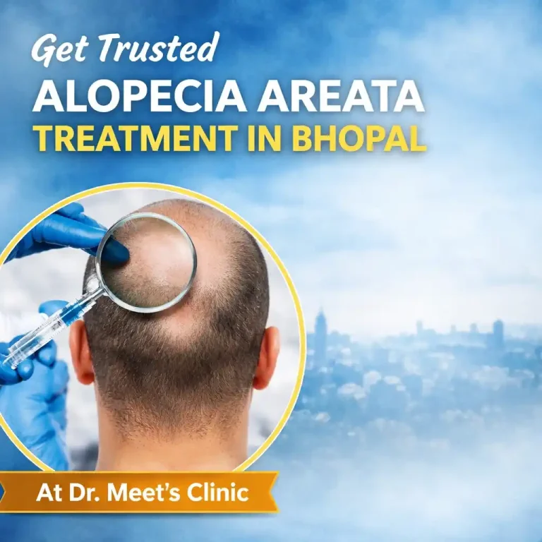 Alopecia Areata Treatment in Bhopal