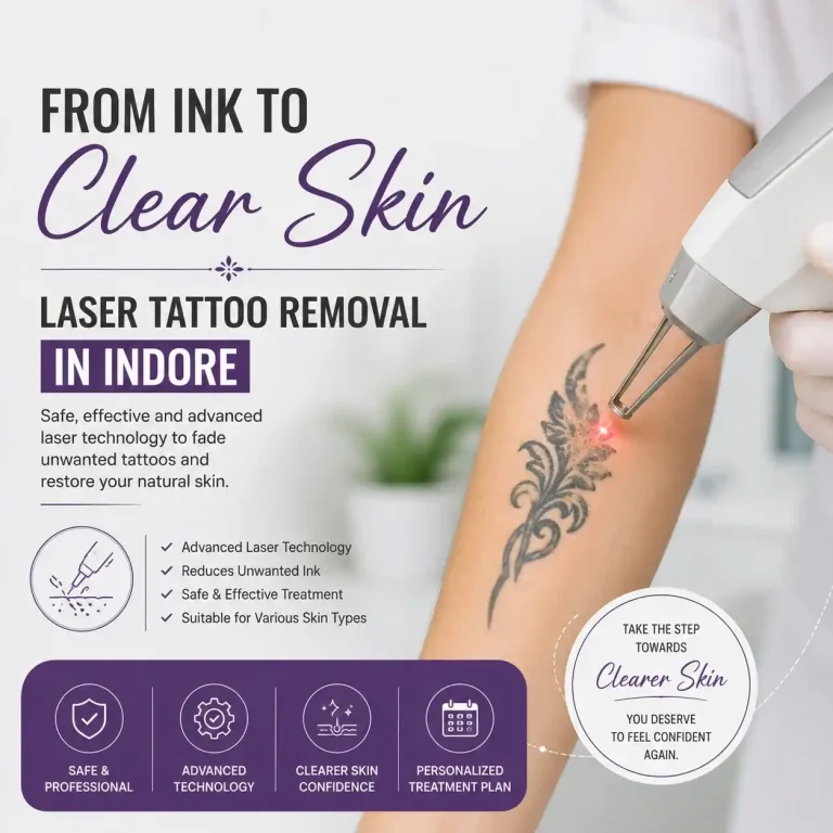 Laser Tattoo Removal in Indore