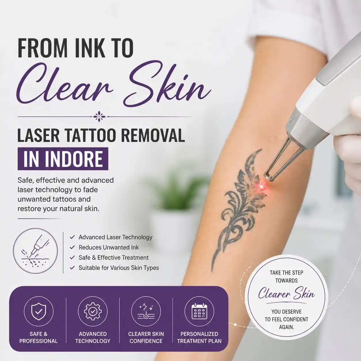 Laser Tattoo Removal in Indore