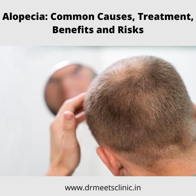 Alopecia Common Causes