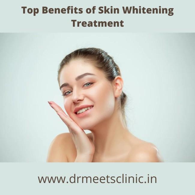 Benefits of Skin Whitening Treatment