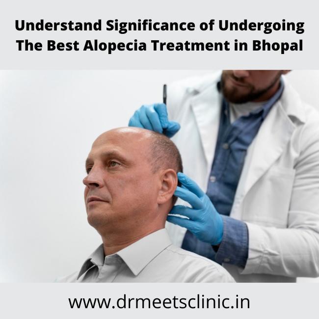Best Alopecia Treatment in Bhopal