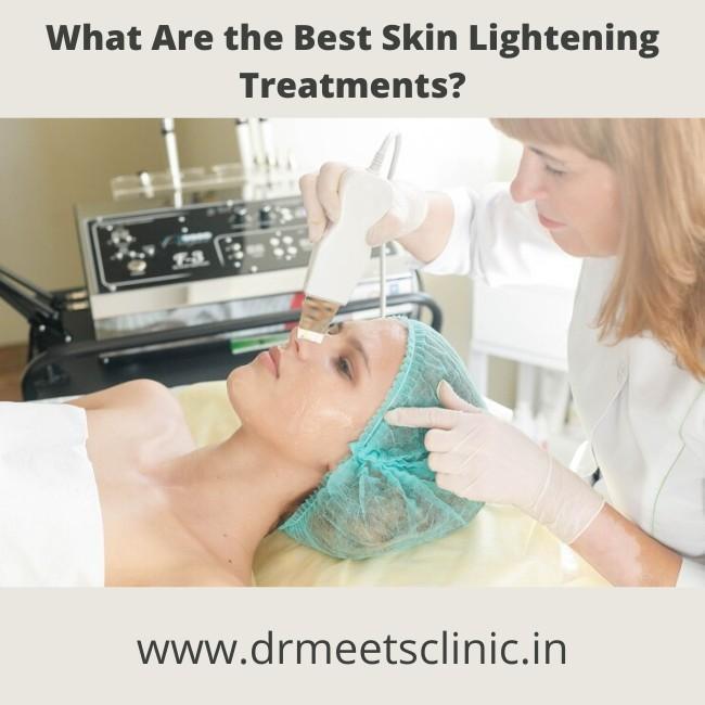 Best Skin-Lightening Treatments