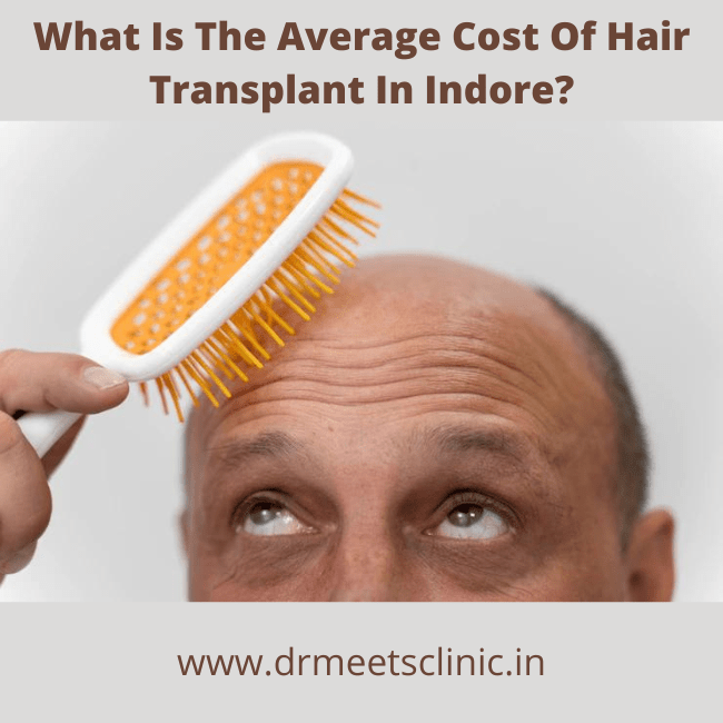 Cost Of Hair Transplant In Indore