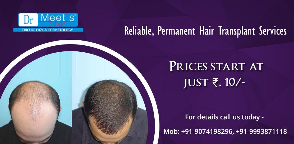 Doctor Recommended Hair Loss Treatment Is Effective And Reliable
