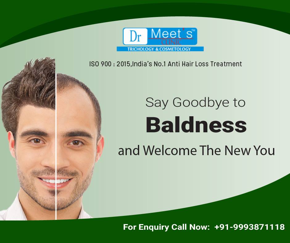 Is a Hair Transplant Worth Its Cost?