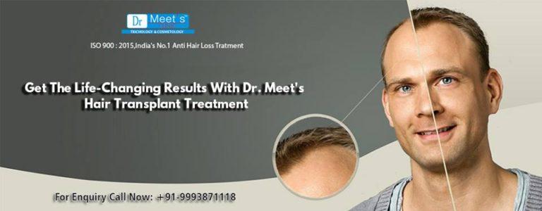 Non Surgical Hair Replacement India
