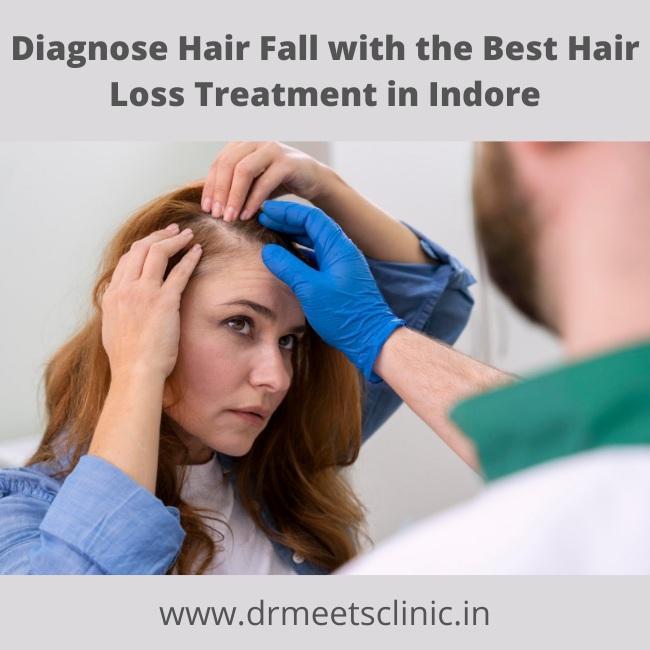 best hair loss treatment in Indore