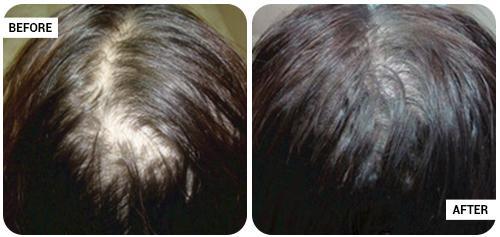 Hair Fall, Hair Loss, Skin Treatment Specialist Doctor