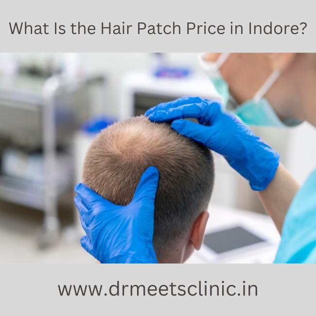 Hair Patch Price in Indore