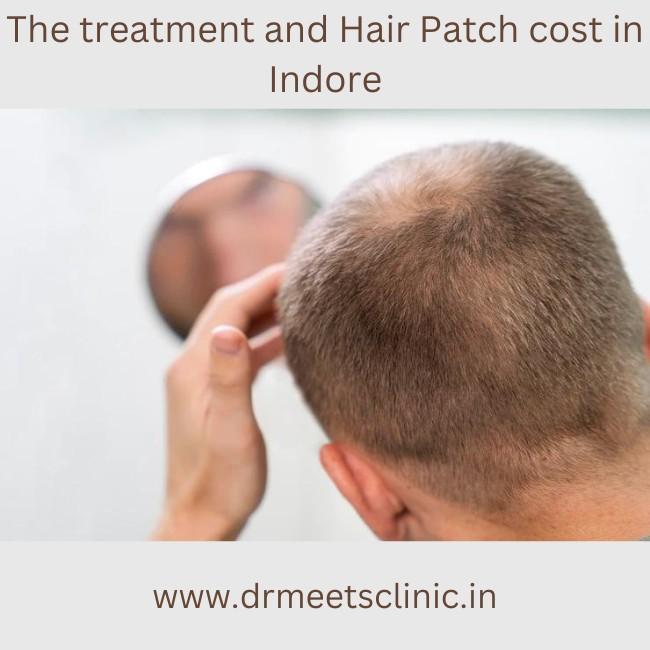 Hair Patch cost in Indore