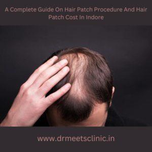 Hair Patch Cost In Indore