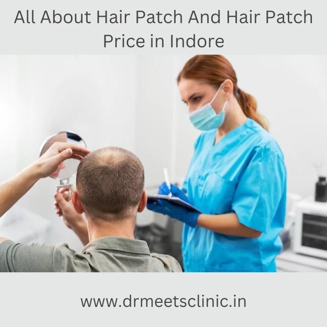 Hair Patch Price_in Indore